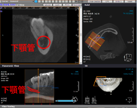 �e�m�炸�FCT�摜�i3�����j